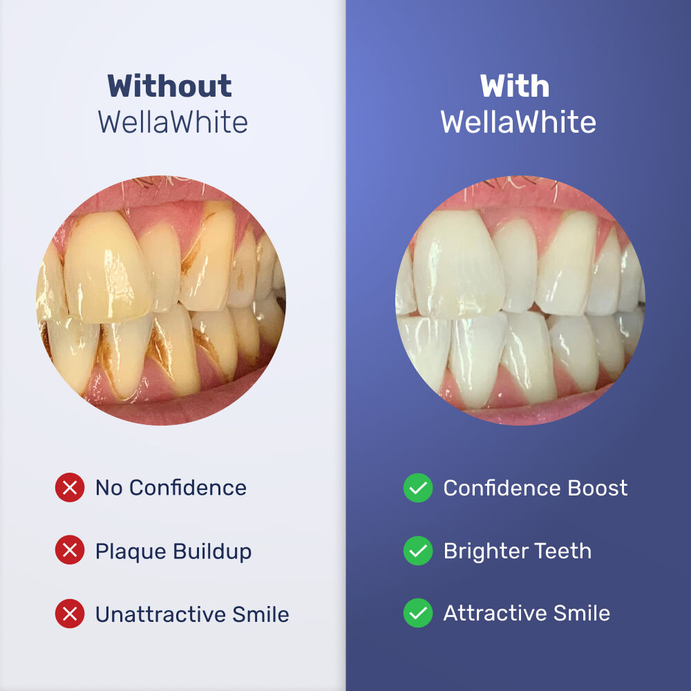 WellaWhite image